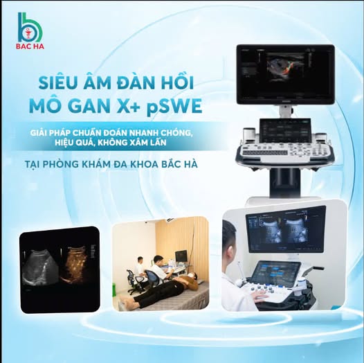 SIÊU ÂM ĐÀN HỒI MÔ GAN CÔNG NGHỆ DẪN ĐẦU X+ pSWE