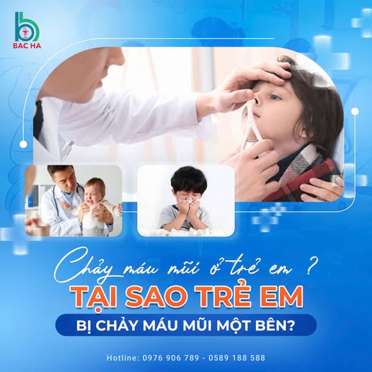 CHẢY MÁU MŨI Ở TRẺ EM? TẠI SAO TRẺ EM BỊ CHẢY MÁU MŨI MỘT BÊN?